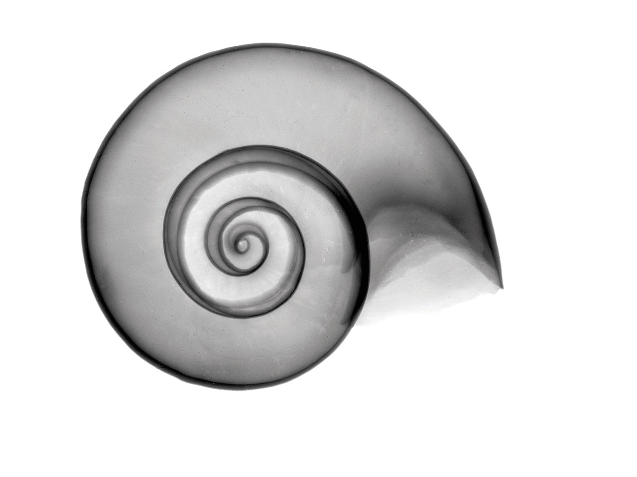 False Ramshorn X-Ray