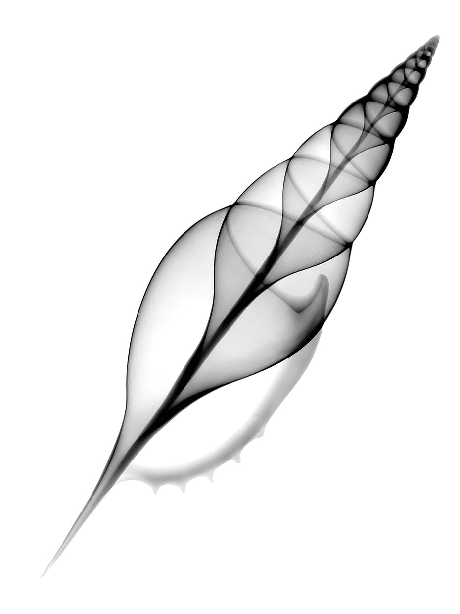 Tibia, Martin's X-Ray