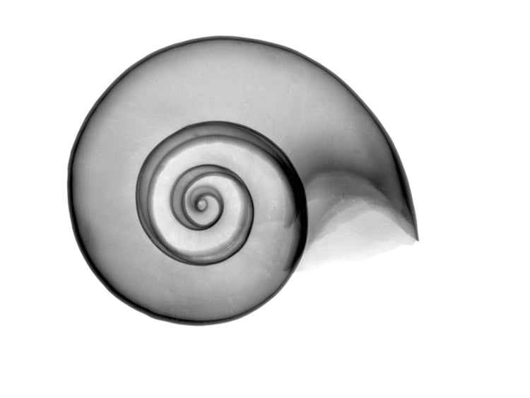 False Ramshorn X-Ray