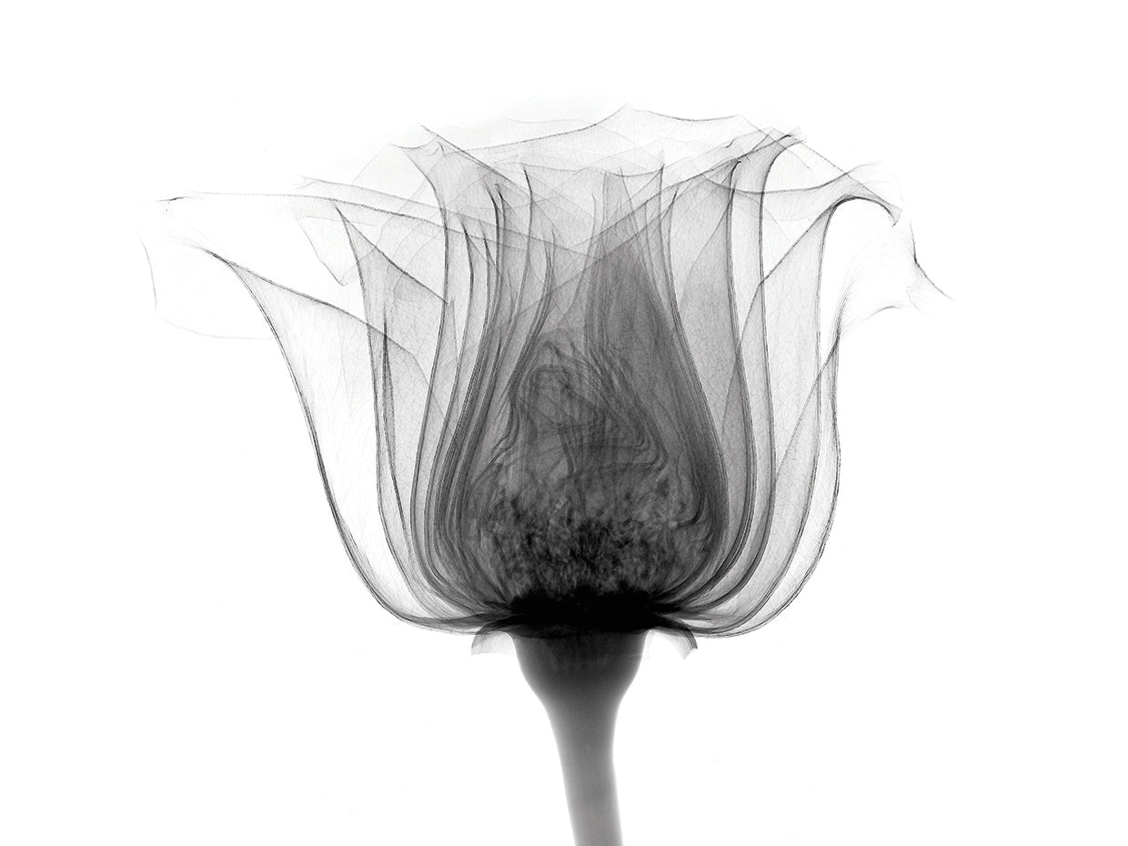 Rose ,Noma X-Ray